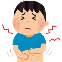 アトピーになった子ども