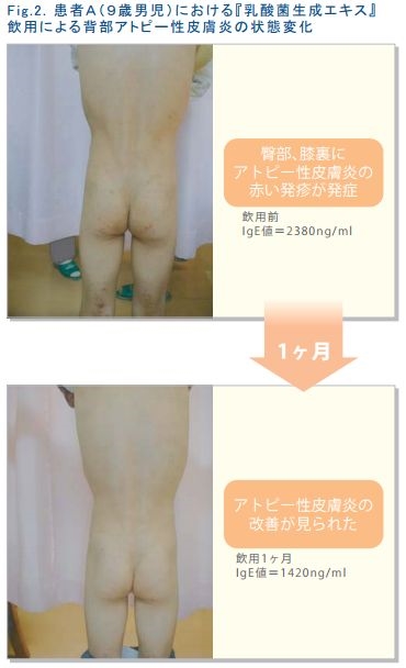 効果効能についてビフォー・アフター